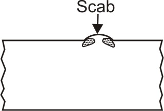 Scab